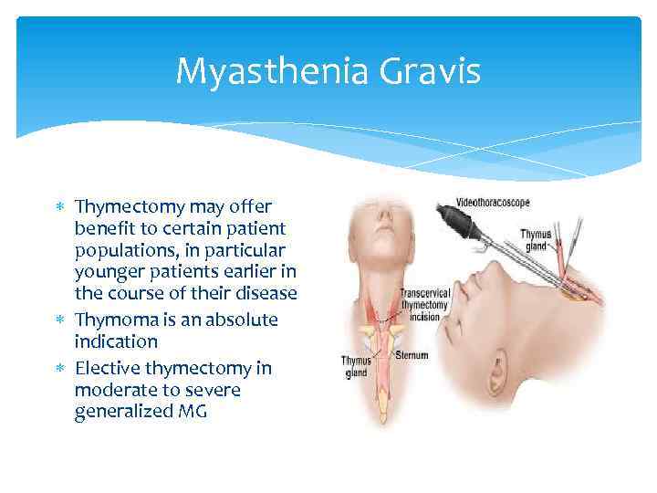 Myasthenia Gravis Thymectomy may offer benefit to certain patient populations, in particular younger patients
