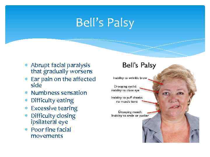 Bell’s Palsy Abrupt facial paralysis that gradually worsens Ear pain on the affected side