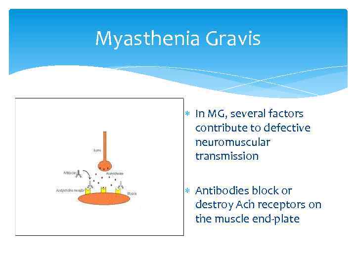 Myasthenia Gravis In MG, several factors contribute to defective neuromuscular transmission Antibodies block or