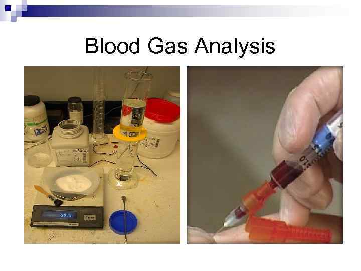 Blood Gas Analysis n TJ Berger MS, PA-C 