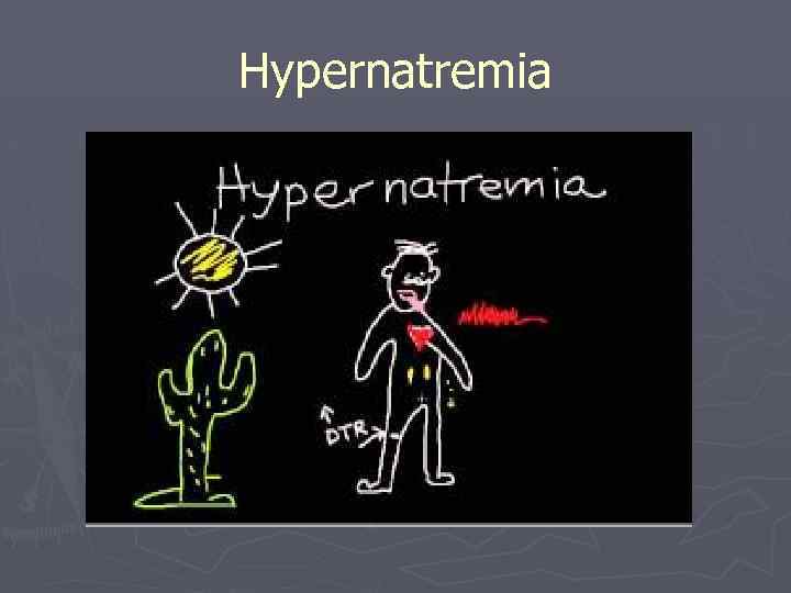 Hypernatremia 