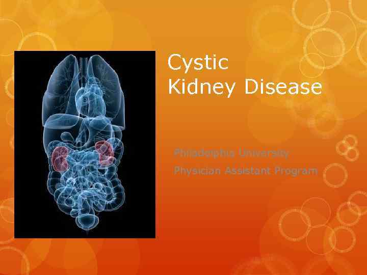 Cystic Kidney Disease Philadelphia University Physician Assistant Program 