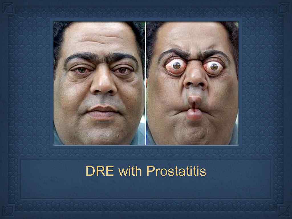 DRE with Prostatitis 