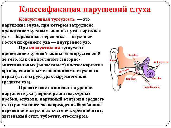 Классификация нарушений слуха Кондуктивная тугоухость — это нарушение слуха, при котором затруднено проведение звуковых