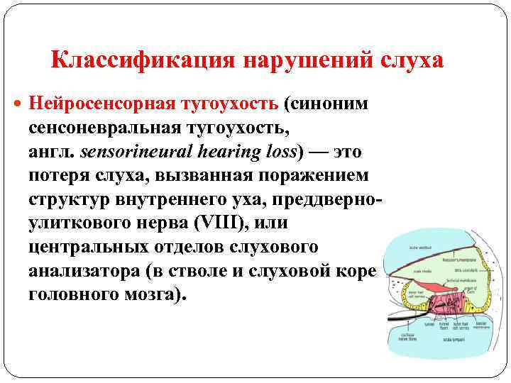 Классификация нарушений слуха Нейросенсорная тугоухость (синоним сенсоневральная тугоухость, англ. sensorineural hearing loss) — это