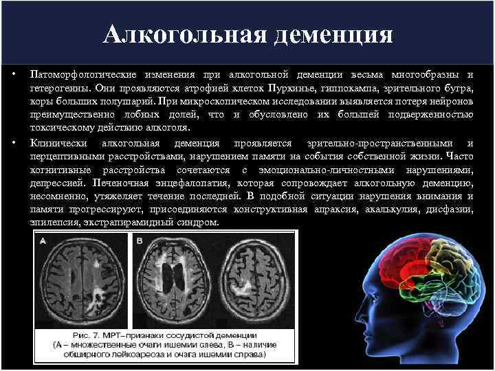 Алкогольная деменция • • Патоморфологические изменения при алкогольной деменции весьма многообразны и гетерогенны. Они