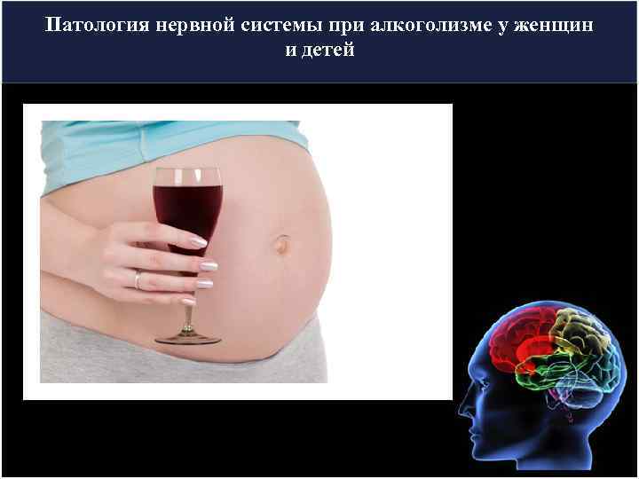 Патология нервной системы при алкоголизме у женщин и детей 