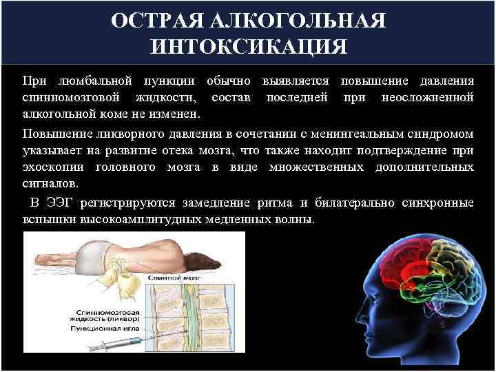 ОСТРАЯ АЛКОГОЛЬНАЯ ИНТОКСИКАЦИЯ При люмбальной пункции обычно выявляется повышение давления спинномозговой жидкости, состав последней