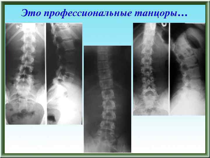 Это профессиональные танцоры… 
