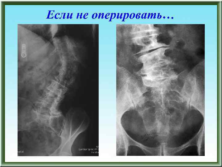 Если не оперировать… 