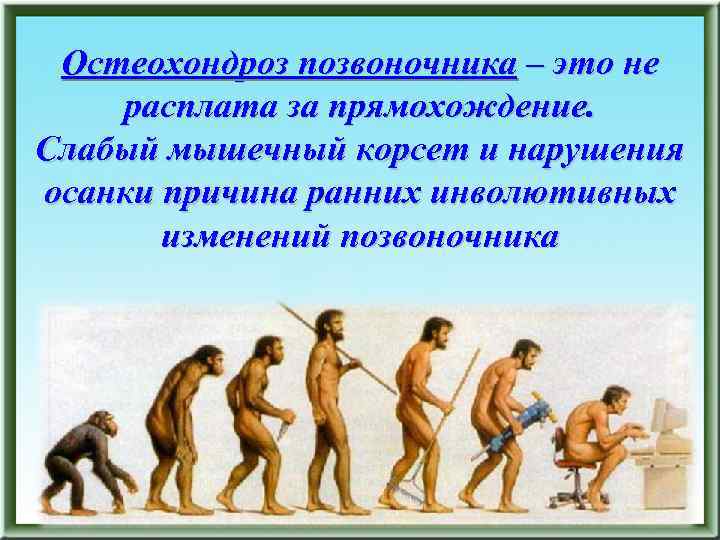 Остеохондроз позвоночника – это не расплата за прямохождение. Слабый мышечный корсет и нарушения осанки