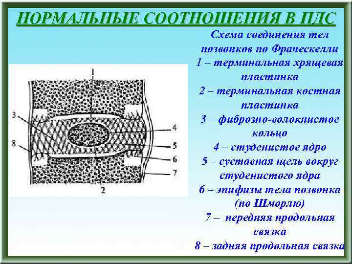 НОРМАЛЬНЫЕ СООТНОШЕНИЯ В ПДС Схема соединения тел позвонков по Фраческелли 1 – терминальная хрящевая