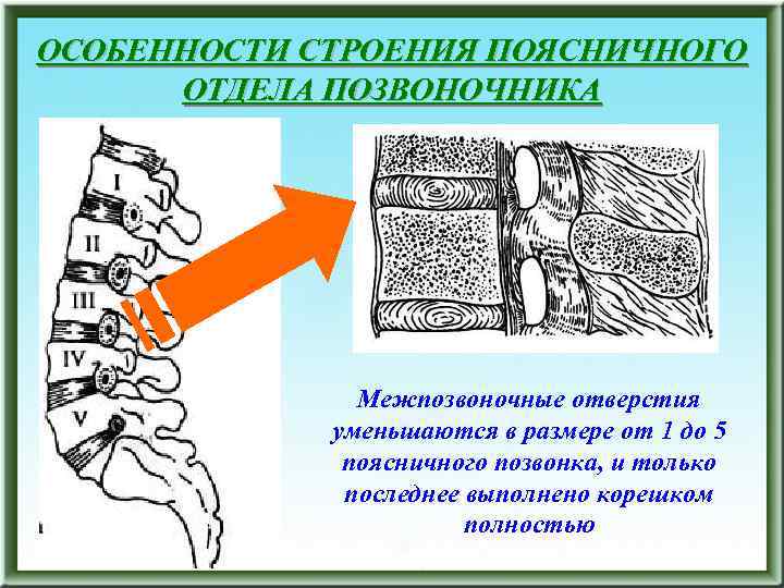 ОСОБЕННОСТИ СТРОЕНИЯ ПОЯСНИЧНОГО ОТДЕЛА ПОЗВОНОЧНИКА Межпозвоночные отверстия уменьшаются в размере от 1 до 5