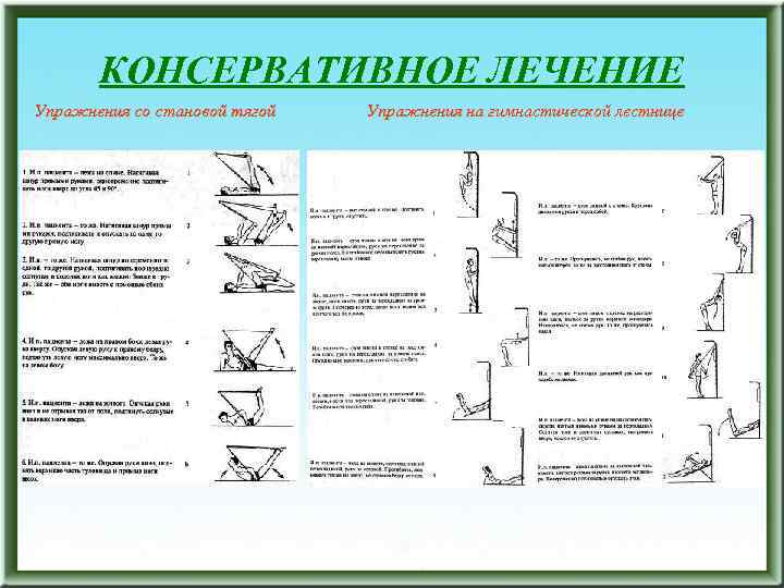 КОНСЕРВАТИВНОЕ ЛЕЧЕНИЕ Упражнения со становой тягой Упражнения на гимнастической лестнице 