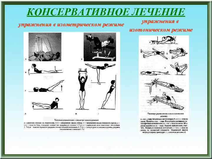 КОНСЕРВАТИВНОЕ ЛЕЧЕНИЕ упражнения в изометрическом режиме упражнения в изотоническом режиме 