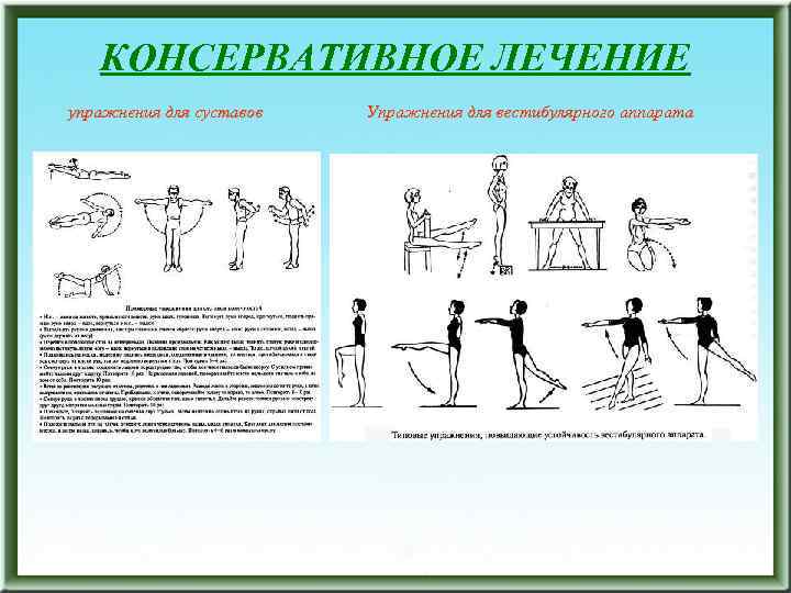 КОНСЕРВАТИВНОЕ ЛЕЧЕНИЕ упражнения для суставов Упражнения для вестибулярного аппарата 