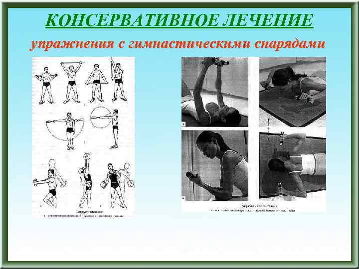 КОНСЕРВАТИВНОЕ ЛЕЧЕНИЕ упражнения с гимнастическими снарядами 