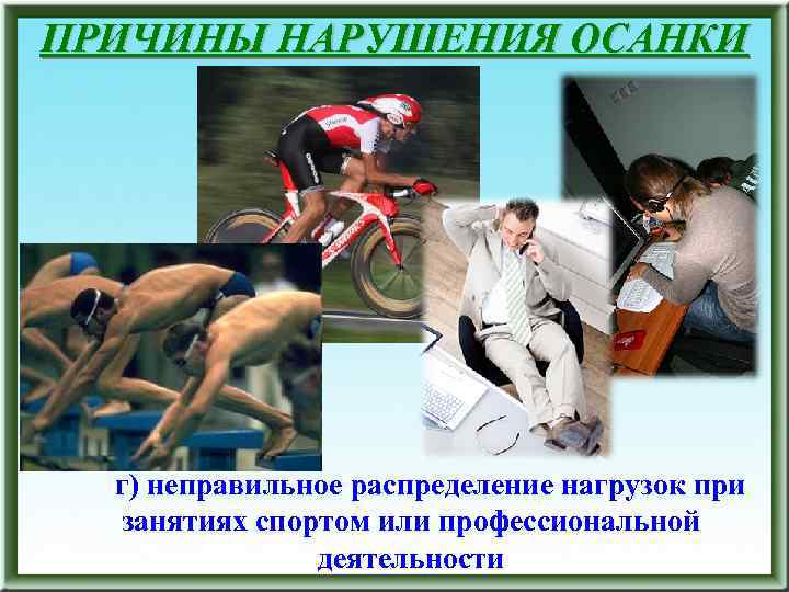 ПРИЧИНЫ НАРУШЕНИЯ ОСАНКИ г) неправильное распределение нагрузок при занятиях спортом или профессиональной деятельности 