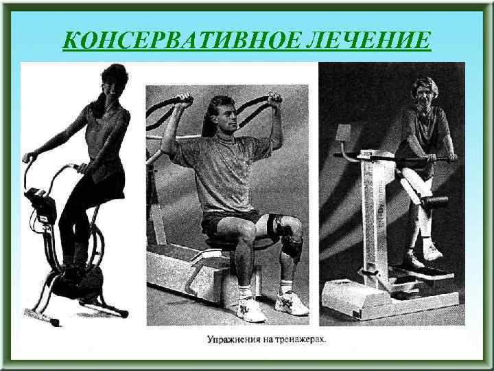 КОНСЕРВАТИВНОЕ ЛЕЧЕНИЕ 