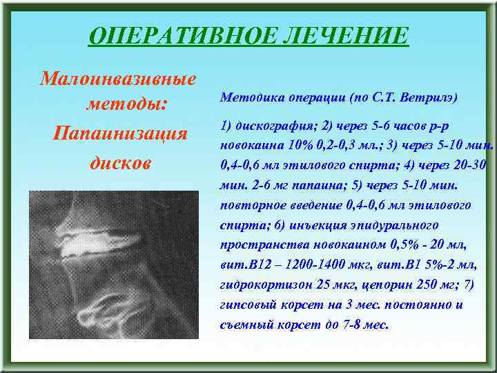 ОПЕРАТИВНОЕ ЛЕЧЕНИЕ Малоинвазивные методы: Папаинизация дисков Методика операции (по С. Т. Ветрилэ) 1) дискография;