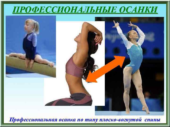 ПРОФЕССИОНАЛЬНЫЕ ОСАНКИ Профессиональная осанка по типу плоско-вогнутой спины 