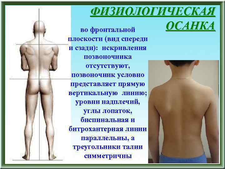 ФИЗИОЛОГИЧЕСКАЯ ОСАНКА во фронтальной плоскости (вид спереди и сзади): искривления позвоночника отсутствуют, позвоночник условно