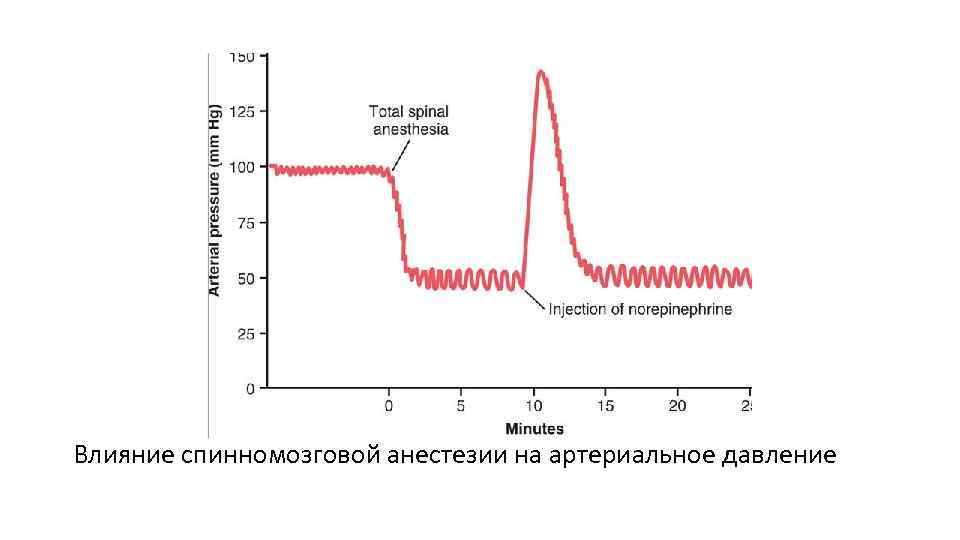Влияние спинномозговой анестезии на артериальное давление 