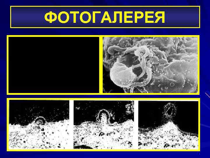 ФОТОГАЛЕРЕЯ 