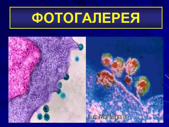 ФОТОГАЛЕРЕЯ 