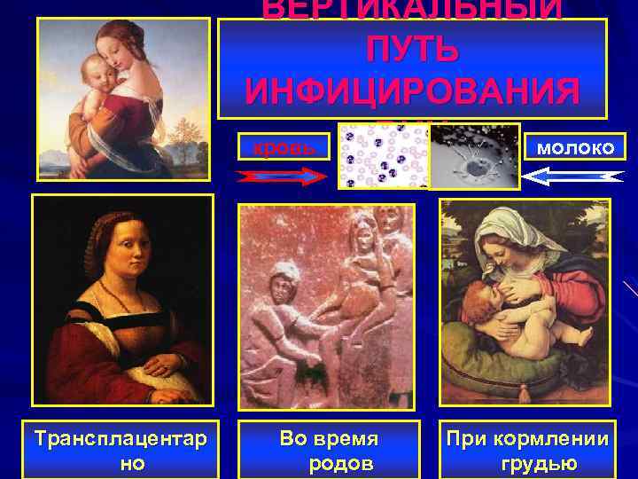 ВЕРТИКАЛЬНЫЙ ПУТЬ ИНФИЦИРОВАНИЯ ВИЧ кровь молоко Трансплацентар но Во время родов При кормлении грудью