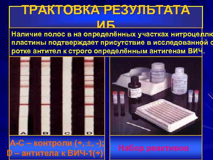 ТРАКТОВКА РЕЗУЛЬТАТА ИБ Наличие полос в на определённых участках нитроцеллю пластины подтверждает присутствие в