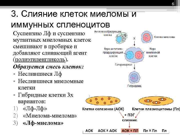 Vrd схема миелома