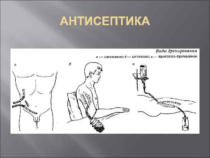 АНТИСЕПТИКА 