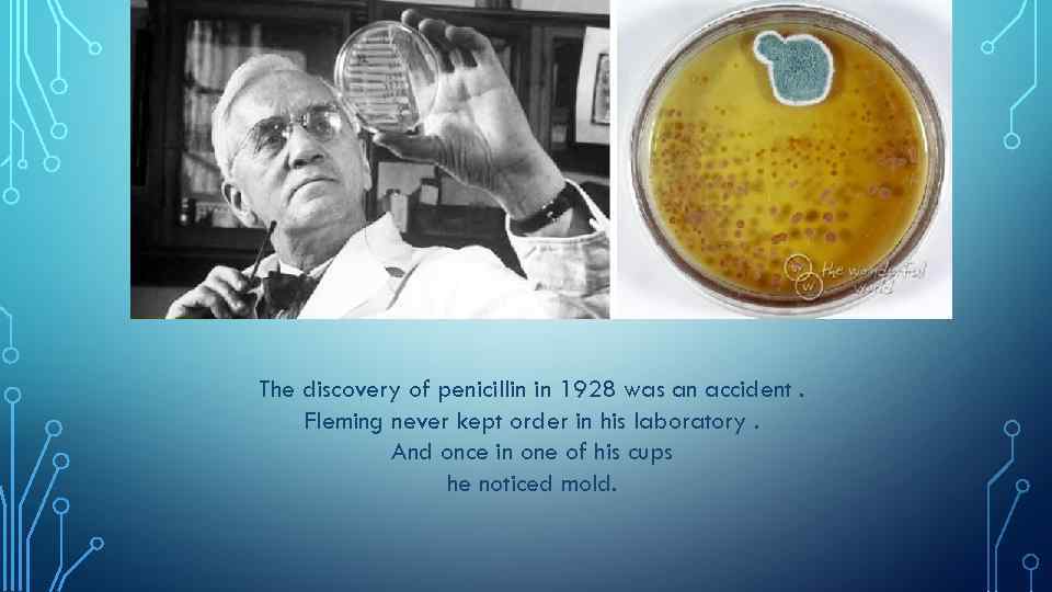 The discovery of penicillin in 1928 was an accident. Fleming never kept order in