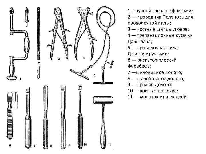 1. - ручной трепан с фрезами; 2 — проводник Поленова для проволочной пилы; 3