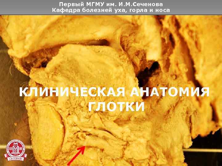 Первый МГМУ им. И. М. Сеченова Кафедра болезней уха, горла и носа КЛИНИЧЕСКАЯ АНАТОМИЯ