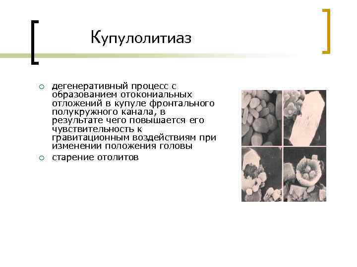 Вестибулярный анализатор физиология презентация