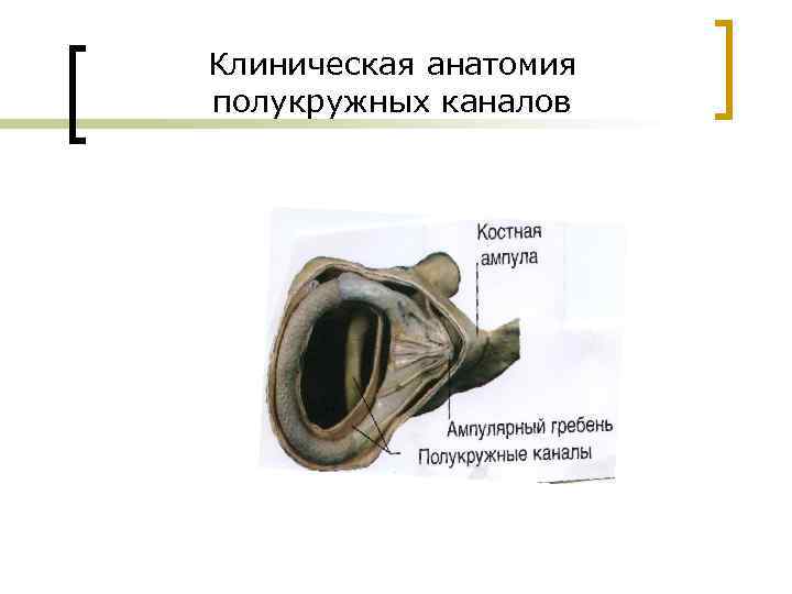 Клиническая анатомия полукружных каналов 