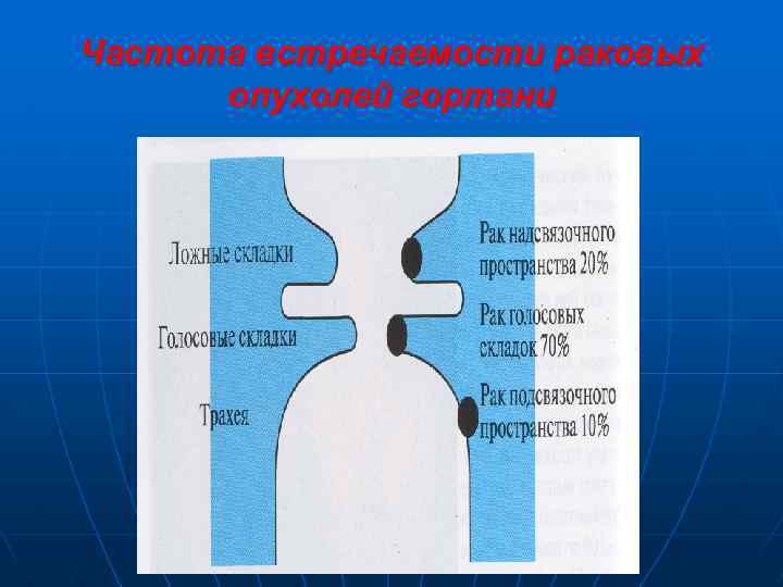 Частота встречаемости раковых опухолей гортани 