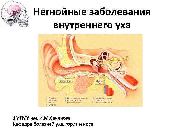 Негнойные заболевания внутреннего уха 1 МГМУ им. И. М. Сеченова Кафедра болезней уха, горла