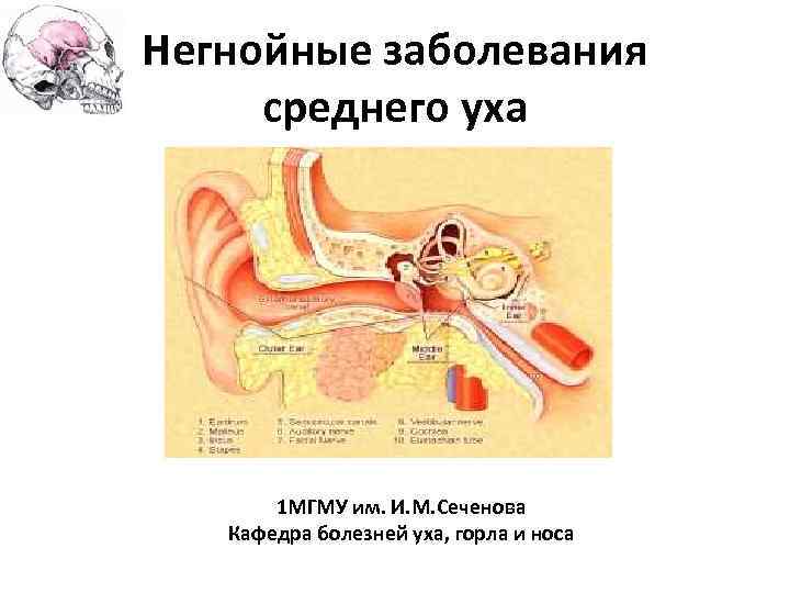 Негнойные заболевания среднего уха 1 МГМУ им. И. М. Сеченова Кафедра болезней уха, горла