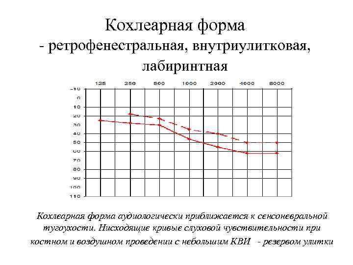 Кохлеарная форма - ретрофенестральная, внутриулитковая, лабиринтная Кохлеарная форма аудиологически приближается к сенсоневральной тугоухости. Нисходящие