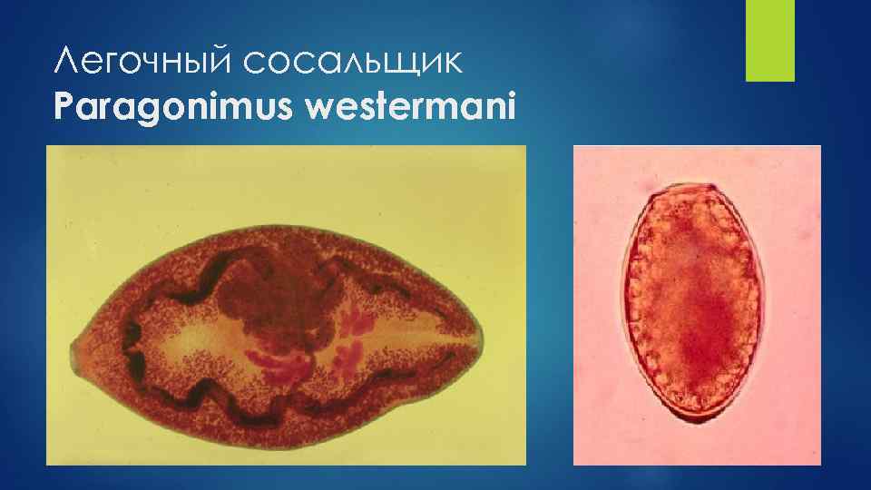 Легочный сосальщик Paragonimus westermani 