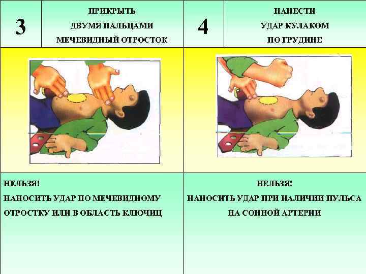 3 ПРИКРЫТЬ ДВУМЯ ПАЛЬЦАМИ МЕЧЕВИДНЫЙ ОТРОСТОК НЕЛЬЗЯ! 4 НАНЕСТИ УДАР КУЛАКОМ ПО ГРУДИНЕ НЕЛЬЗЯ!