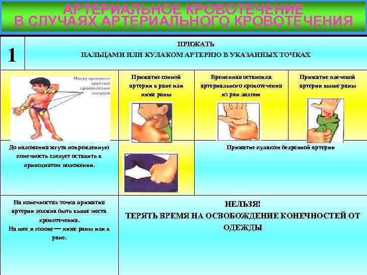 АРТЕРИАЛЬНОЕ КРОВОТЕЧЕНИЕ В СЛУЧАЯХ АРТЕРИАЛЬНОГО КРОВОТЕЧЕНИЯ 1 ПРИЖАТЬ ПАЛЬЦАМИ ИЛИ КУЛАКОМ АРТЕРИЮ В УКАЗАННЫХ