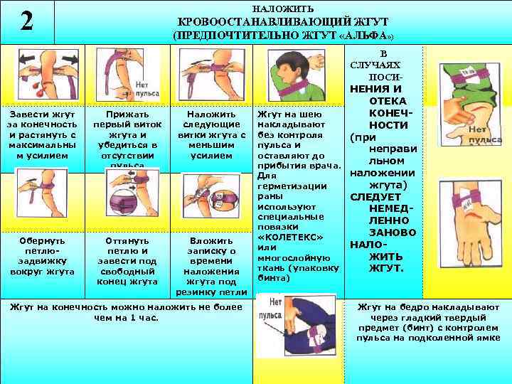 НАЛОЖИТЬ 2 КРОВООСТАНАВЛИВАЮЩИЙ ЖГУТ (ПРЕДПОЧТИТЕЛЬНО ЖГУТ «АЛЬФА» ) Завести жгут за конечность и растянуть