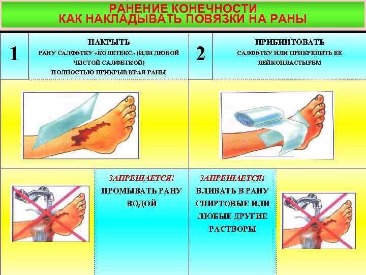 РАНЕНИЕ КОНЕЧНОСТИ КАК НАКЛАДЫВАТЬ ПОВЯЗКИ НА РАНЫ 1 НАКРЫТЬ РАНУ САЛФЕТКУ «КОЛЕТЕКС» (ИЛИ ЛЮБОЙ