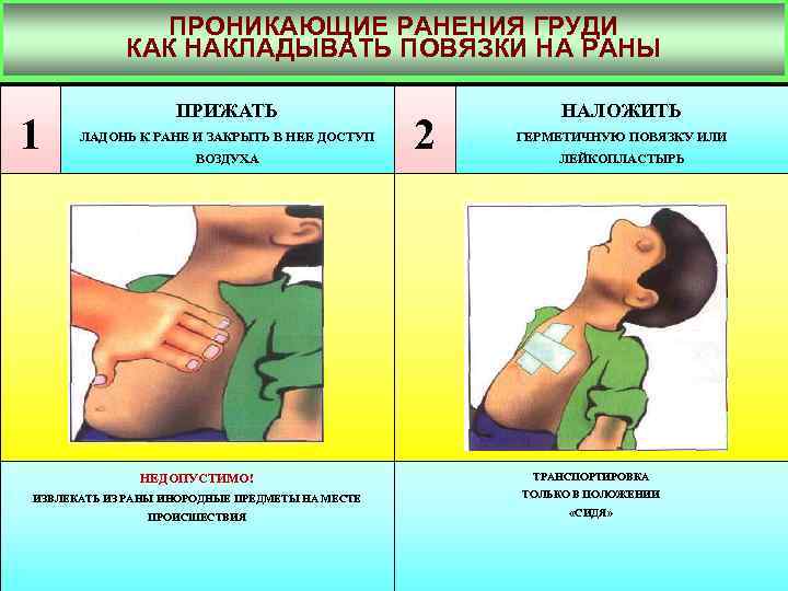 Проникающее ранение грудной. Проникающие и непроникающие ранения груди. Проникающая колотая рана груди. Проникающие ранения груди как накладывать повязки на раны. Первая помощь при непроникающих ранениях.