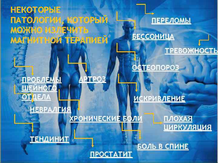 НЕКОТОРЫЕ ПАТОЛОГИИ, КОТОРЫЙ МОЖНО ИЗЛЕЧИТЬ МАГНИТНОЙ ТЕРАПИЕЙ ПЕРЕЛОМЫ БЕССОНИЦА ТРЕВОЖНОСТЬ ОСТЕОПОРОЗ ПРОБЛЕМЫ ШЕЙНОГО ОТДЕЛА