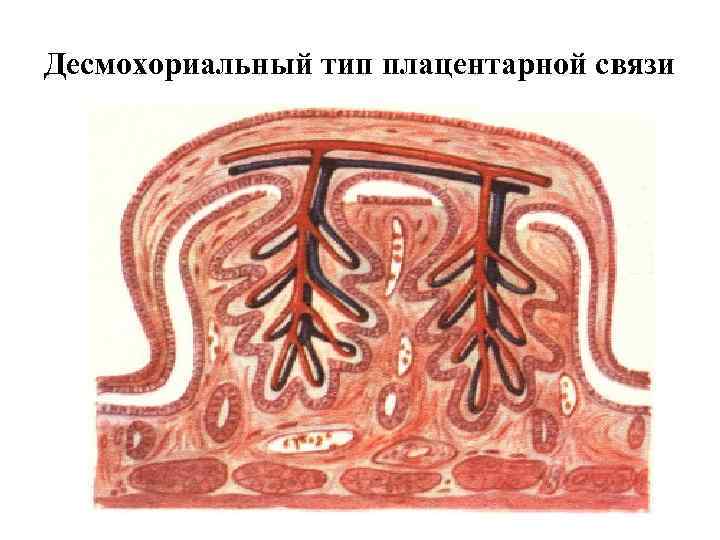 Десмохориальный тип плацентарной связи 